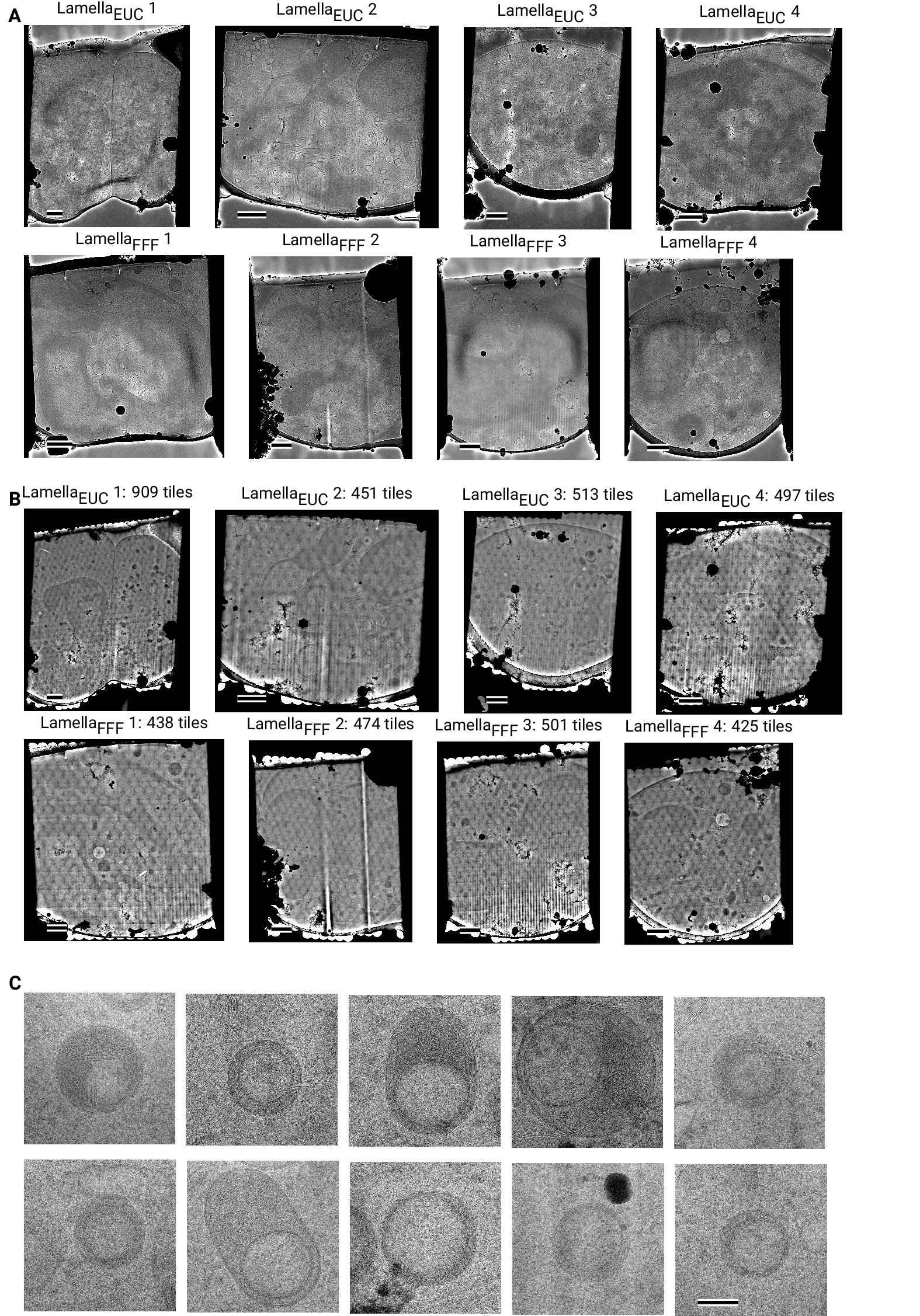 Figure 4 - figure supplement 4: Overview images of lamellae imaged using the DeCo-LACE approach taken at low-magnification (A) Overviews taken at low magnification. Scalebar corresponds to 1 μm. (B) Overviews assembled using the DeCo-LACE approach. Scalebar corresponds to 1 μm. (C) Representative examples of a class of granules containing a putatively cytosolic inclusion. Scalebar corresponds to 100 nm.